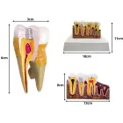 Anatomical tooth cross-section model, educational — Photo 3