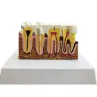 Anatomical tooth cross-section model, educational — Photo 8
