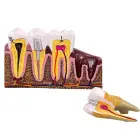 Anatomical tooth cross-section model, educational — Photo 2