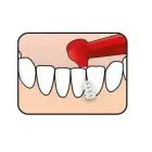 TePe Interstitial Brushes - 6 Pcs Foto 2