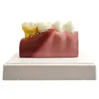 Anatomical tooth cross-section model, educational — Photo 5