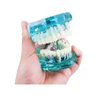 Dental jaw model with implants — Photo 9